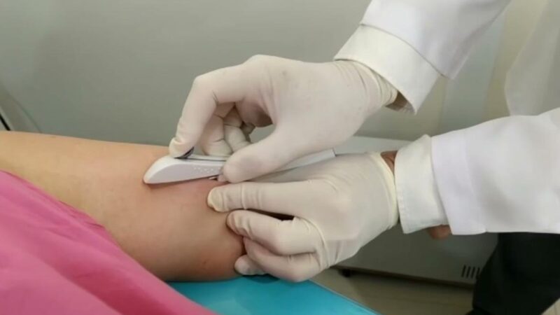 Aracruz capacita médicos e inicia oferta de Implanon na rede pública
