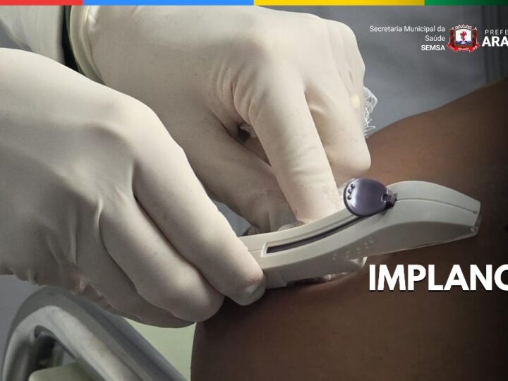 Implanon passa a contar com protocolo específico na Atenção Primária à Saúde