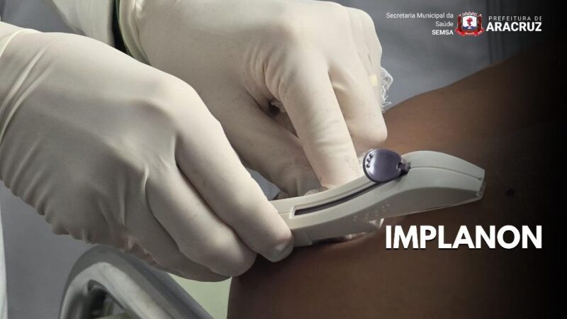 Implanon passa a contar com protocolo específico na Atenção Primária à Saúde